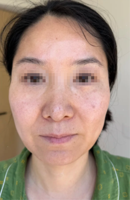 더마팩토리 비타민c 두 달 쓰고 대신 찾은 것