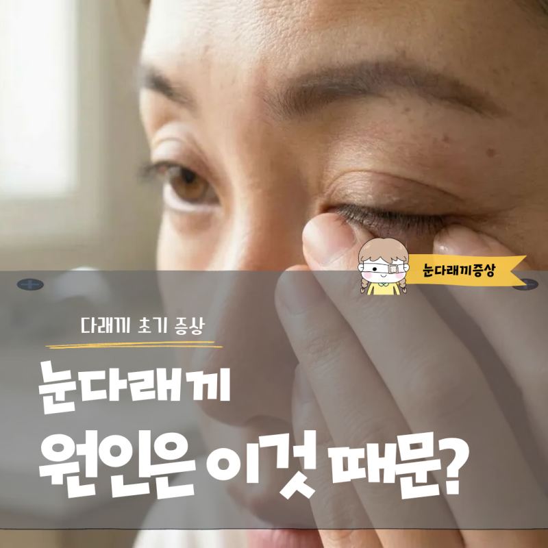 눈다래끼 원인 이것 때문? 다래끼 초기 증상과 빨리 낫는법