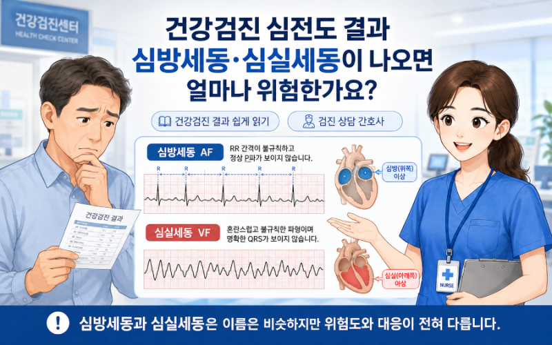 건강검진 심전도에서 심방세동·심실세동이 나오면 얼마나 위험한가요? 건강검진 결과 쉽게 ....