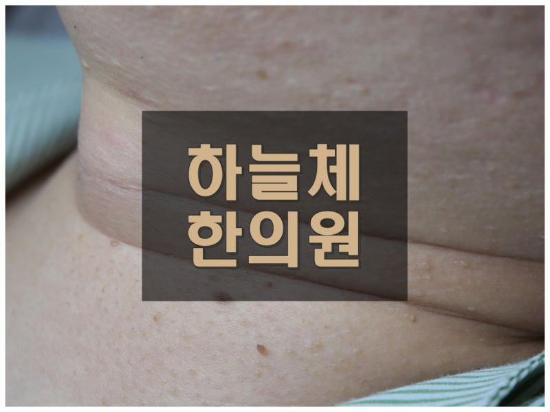 창원 편평사마귀 제거했는데 다시 보인다면 같은 병변이 재발한 걸까요?