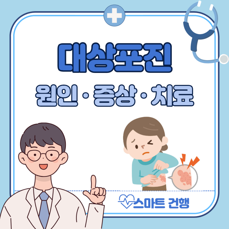 대상포진 초기 증상, 전염성, 원인, 치료 기간 : 얼굴, 팔, 허리
