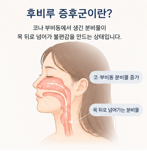아침마다 목에 가래가 붙는 느낌? 후비루 증후군 원인과 치료