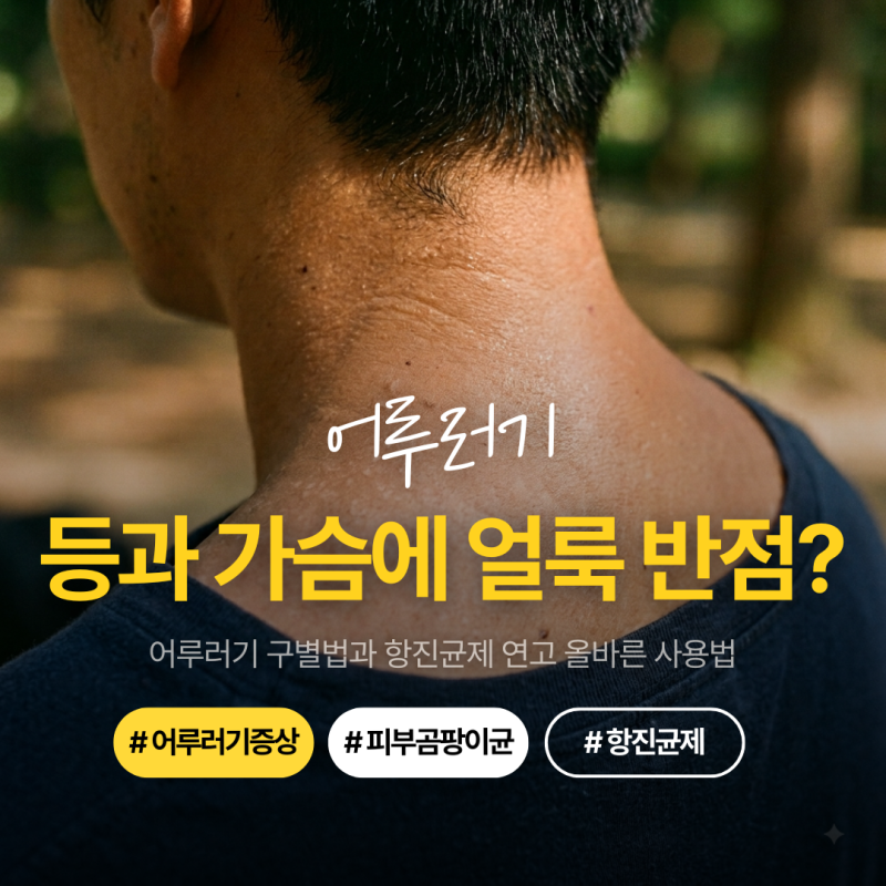 때가 낀 줄 알고 밀었다가 얼룩덜룩 해진 피부, 어루러기 증상 잡는 연고 사용법과 예방법 4....