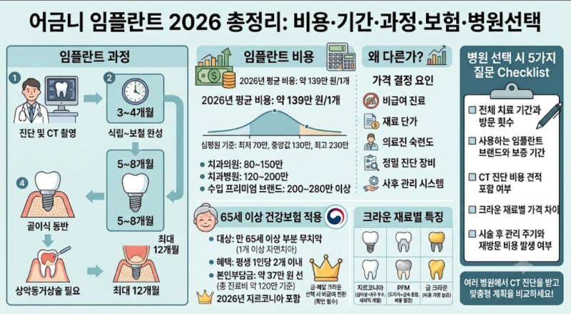 어금니 임플란트 비용 기간 과정 총정리 (2026년 실제 가격 포함)