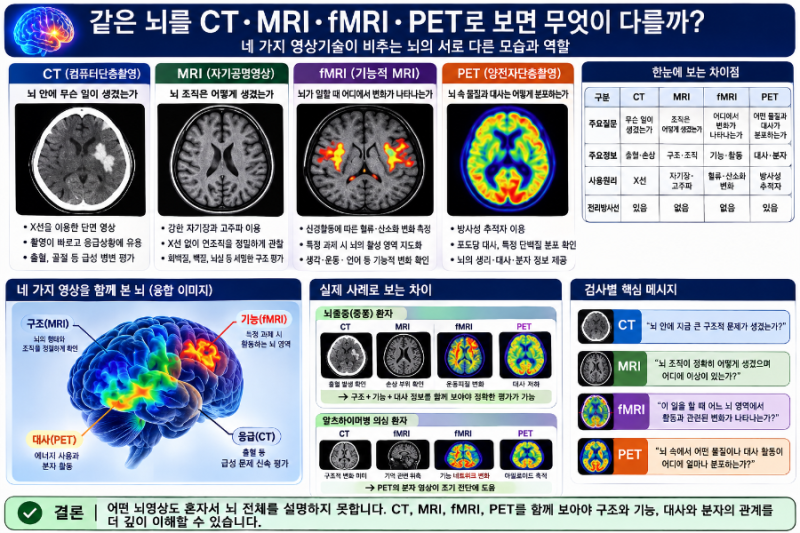 브레인 이미징으로 뇌를 발견하다. 5부｜같은 뇌를 CT·MRI·fMRI·PET로 보면 무엇이 다를까