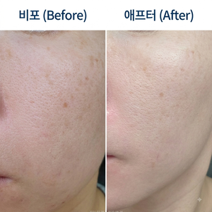 [내돈내산] 러닝과 출산 후 짙어진 기미, 홍현희 무속인 세일로 득템한 이지듀 기미앰플 부스....