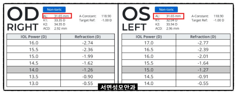 부산안과 라식 후 백내장, 인공수정체 선택이 더 까다로운 이유