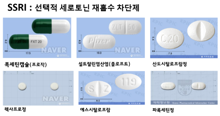 스트레스성 공황장애 증상 원인과 극복을 위한 치료 방법
