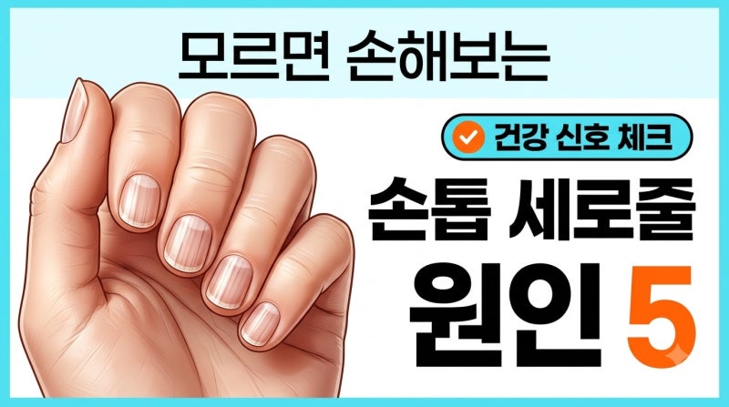 모르면 손해보는 손톱 세로줄 원인 5가지 핵심 정리 (실제 경험담)