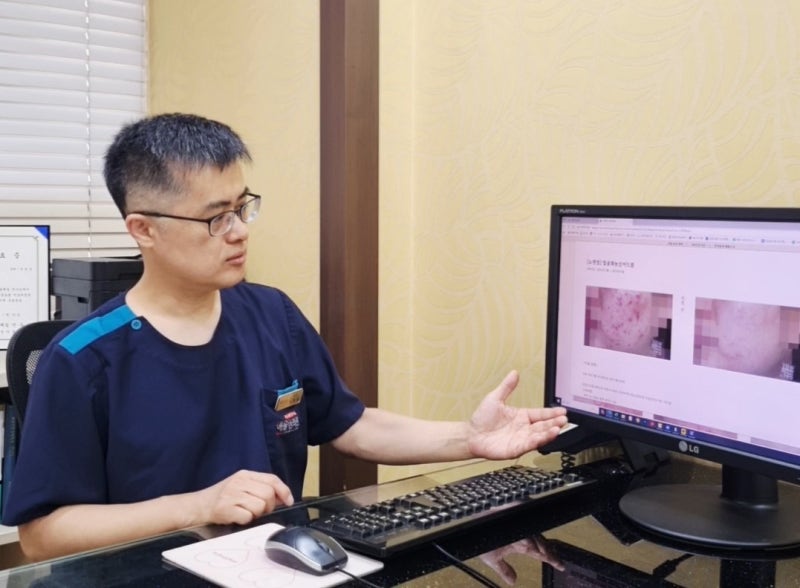 노원 염증주사 패인흉터 남는 이유와 재생 치료 방법은?