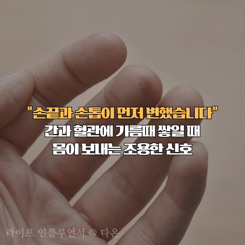 "손끝과 손톱이 먼저 변했습니다" 간과 혈관에 기름때 쌓일 때 몸이 보내는 조용한 신호 4가....