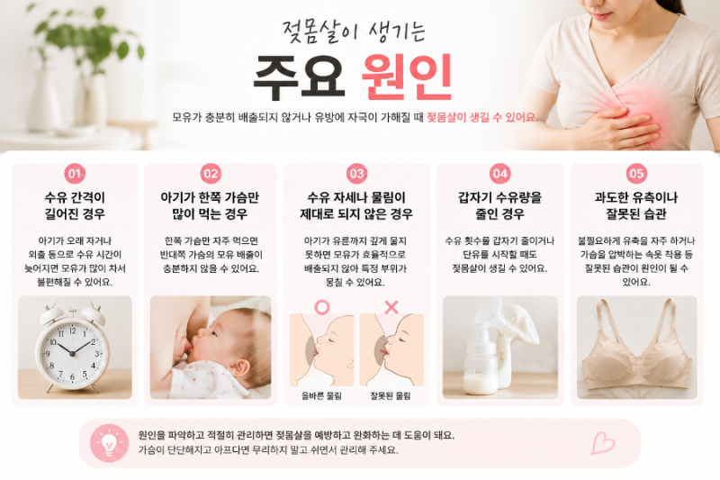 젖몸살 증상과 원인, 모유수유 중 가슴이 단단하고 아플때 대처법! 유방울혈