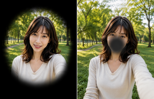 송승환 쯔양 시각장애 원인 망막색소변성증 황반변성 증상 치료 가능할까?