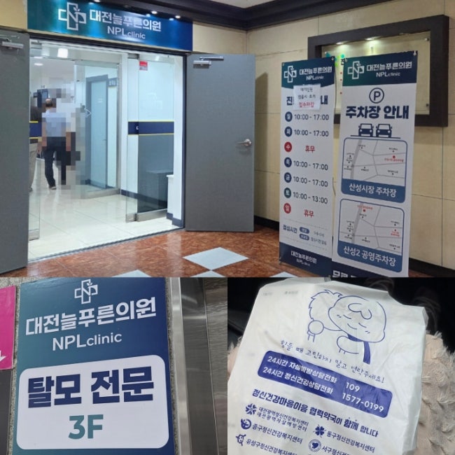 대전 늘푸른의원 산성동 탈모 입소문난 병원 다녀온후기