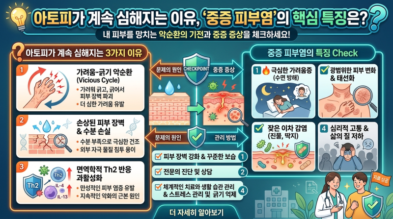 아토피가 계속 심해지는 이유, 중증 피부염의 특징은?