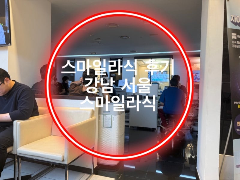 내돈내산 압구정 강남 스마일라식 솔직 후기 + 병원 정보, 지인 할인