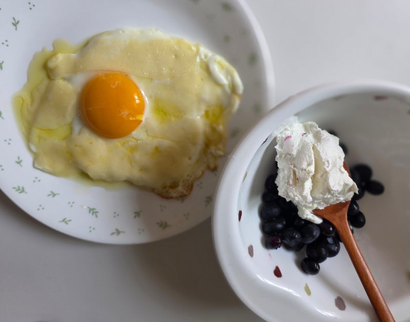 치질수술 후기 2달차｜외래 졸업, 수술 후 삶의 질은 정말 달라졌을까?