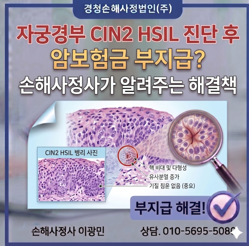 자궁경부 CIN2 HSIL 진단 후 암보험금 부지급? 손해사정사가 알려주는 해결책