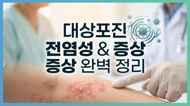 대상포진 전염성 얼마나 높을까? 증상 감염 원인 치료법 총정리