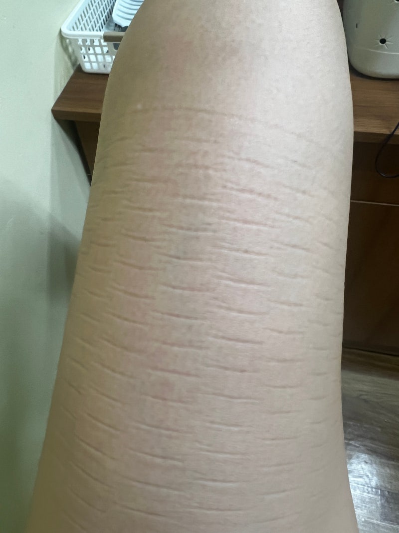 오투스킨 셀룰라이트팬티 레드라벨 — 러닝머신 운동할 때 입어본 후기