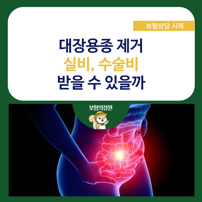대장용종 제거 실비, 수술비 받을 수 있을까