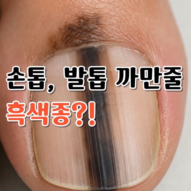 "발톱에 까만 줄 하나 생겼는데..." 이거 괜찮은 걸까?