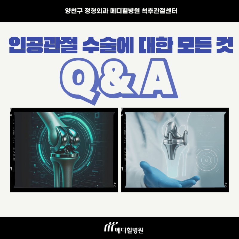 양천구 정형외과 메디힐병원- 인공관절 수술에 대한 모든 것 Q&A