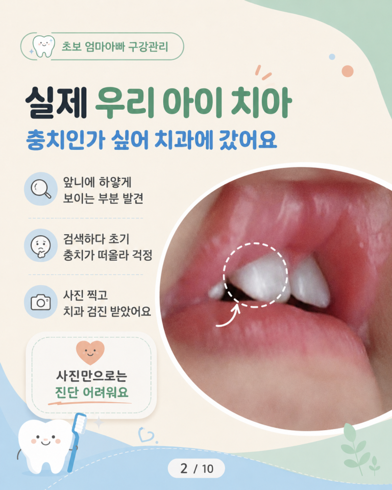 아기 충치 초기증상? 앞니 흰 반점 치과 구강검진 갔다 온 결과는?