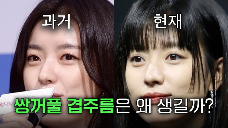 겹주름 쌍꺼풀 원인과 해결방법