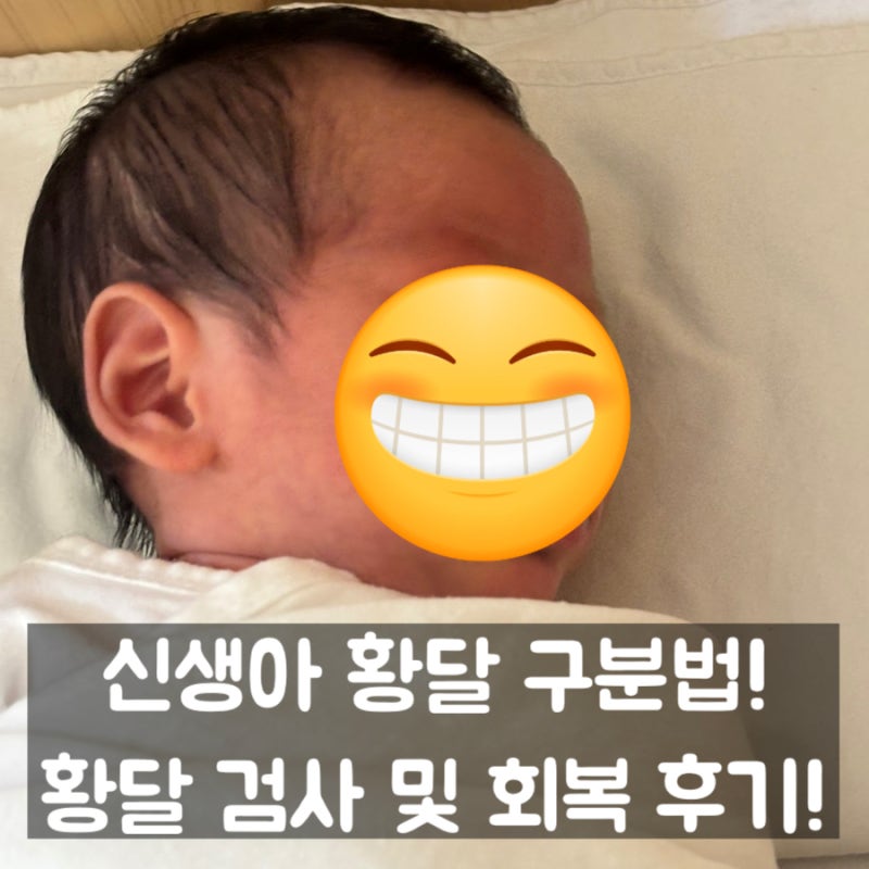 신생아 황달 수치 및 눈동자 황달 구분법! 황달 병원 검사 후기!