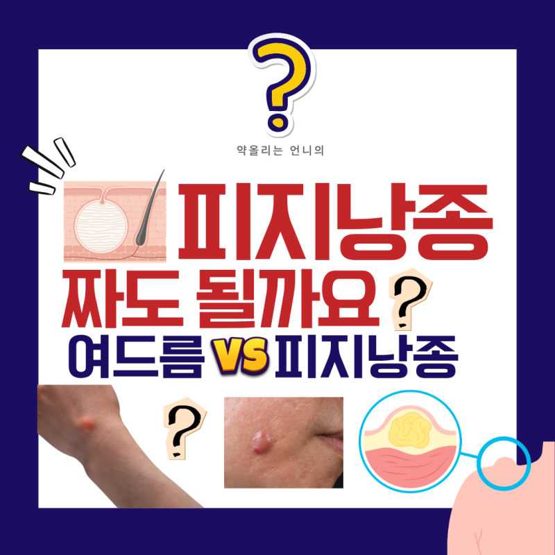 피지낭종 짜도 될까요? 짜면 안 되는 진짜 이유!(여드름 vs 표피낭종)