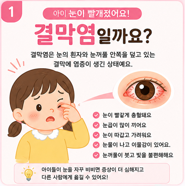 아이 눈이 빨개졌어요! 결막염 증상과 전염성, 어린이집 등원 기준