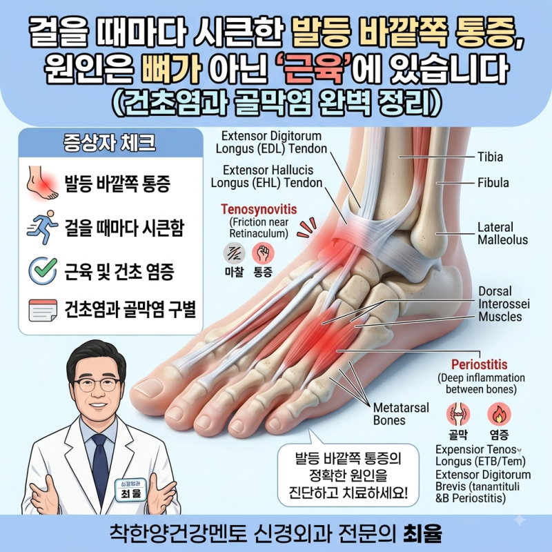 걸을 때마다 시큰한 발등 바깥쪽 통증, 원인은 뼈가 아닌 '근육'에 있습니다 (건초염과 골막....