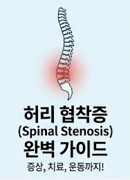포항PT가 알려주는 허리 협착증 증상부터 좋은 운동·치료법까지! 허리디스크와 다른 점 총정....