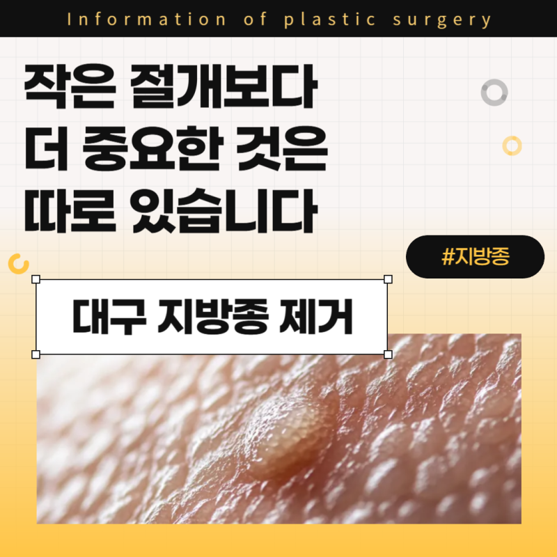 대구 지방종 제거, 작은 절개보다 더 중요한 것은 따로 있습니다