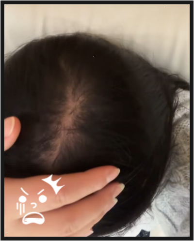 아렌산성샴푸 두 달 쓰고 놀란 얘기, 미용실에서 들은 한마디 때문에