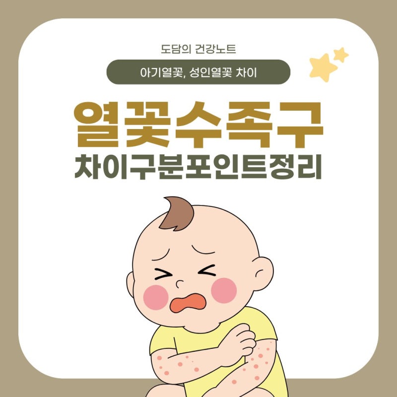아기 열꽃 수족구 차이 구분 포인트 정리