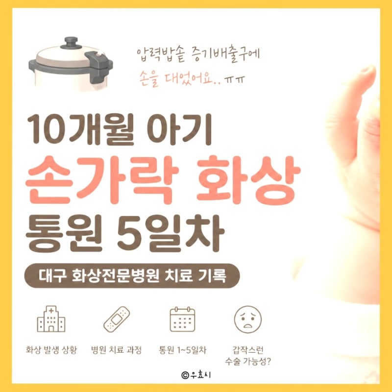 10개월 아기 손가락 화상 통원 5일차 (대구 화상전문병원)