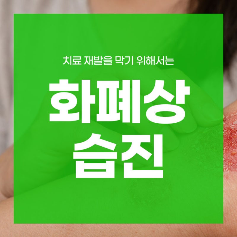 화폐상습진 치료 재발을 막기 위해서는