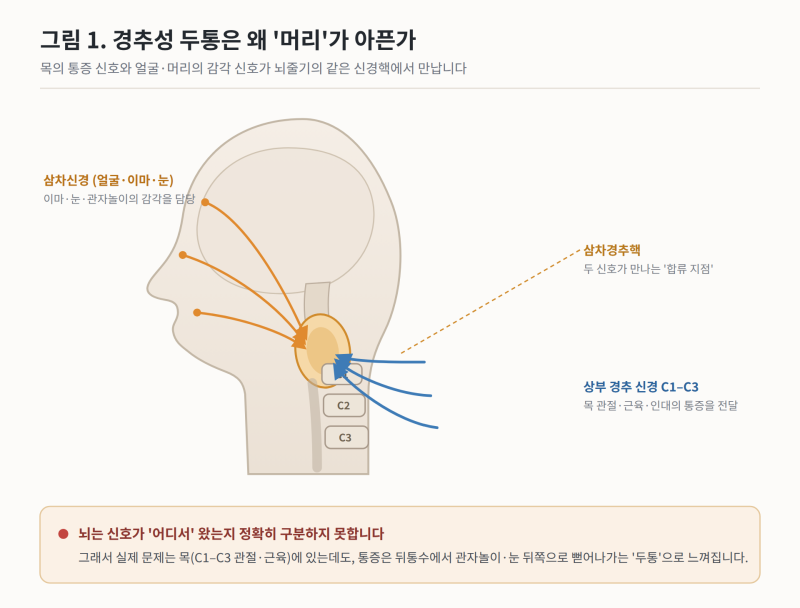 (평촌, 범계) 연세탑재활의학과 경추성 두통