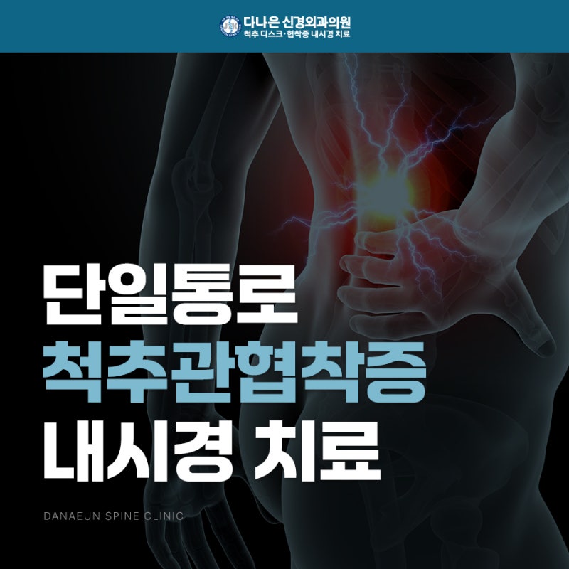 척추 명의 추천 척추관협착증 내시경수술 PESS란?