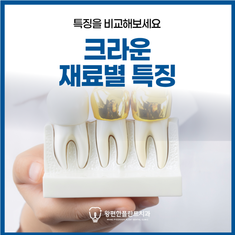 전곡역치과 크라운 재료마다 다른 특징을 비교해보세요