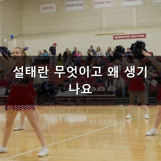 설태 원인 하얗게 낀 혀의 정체와 올바른 대처 방법