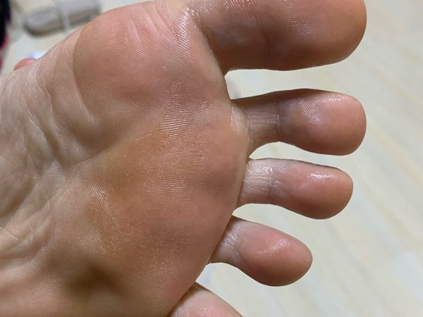 약국 무좀약 신신제약 무조무 스프레이 알파 사용법 팁