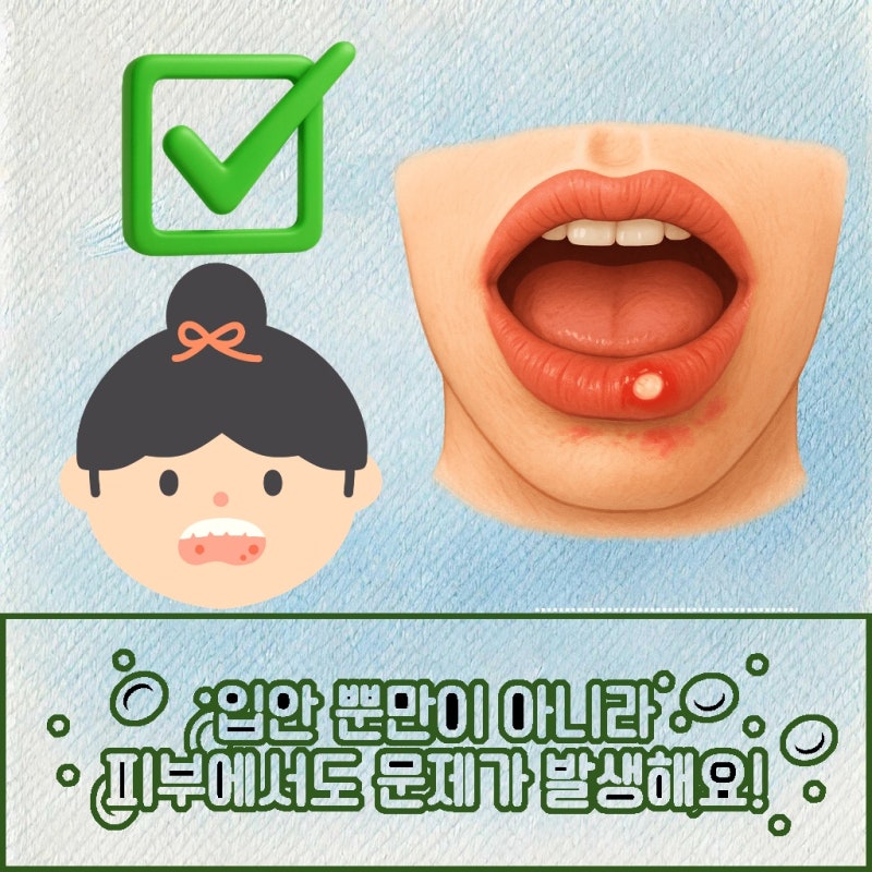 베체트병검사 방법 어떤 과정으로 진행될까요?