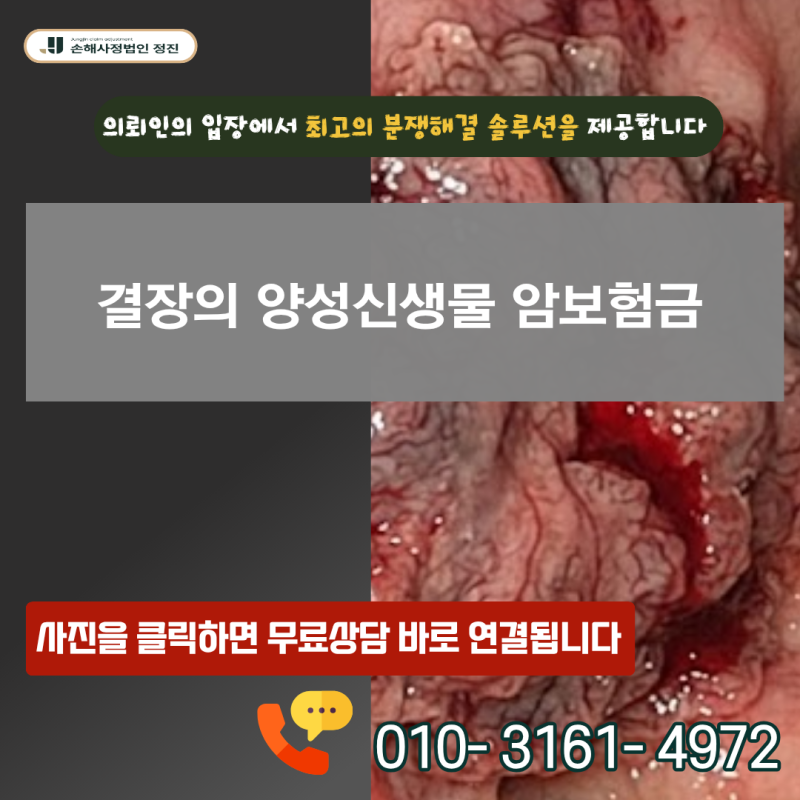결장의 양성신생물 암보험금, D12.6 진단서로 일반암 진단비를 수령할 수 있을까?
