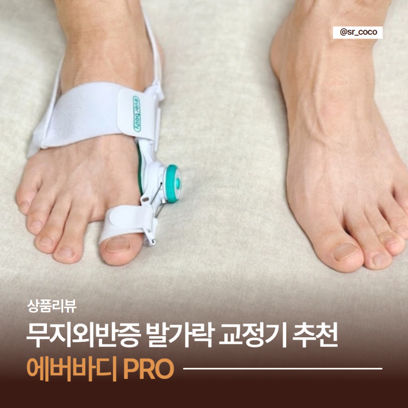 무지외반증 교정기 추천 에버바디 PRO 비싼 돈 버리고 정착한 한 달 사용 후기