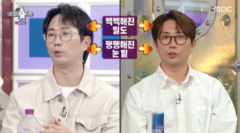 "김우빈 따라 했다가..." 라디오스타 출연한 이창호가 모발 이식·눈밑 지방 재배치 후 들은 ....
