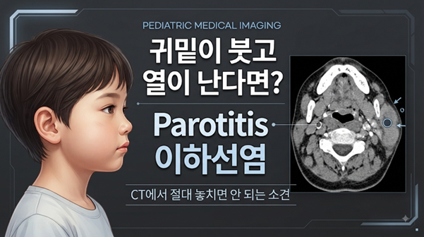 Case Review_236-열이 나고 씹을 때 귀밑의 통증과 볼이 부어오른 8세 남아-Parotitis(이하선염)