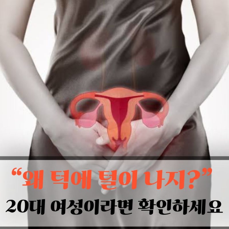 살찌고, 여드름, 털까지..산과 의사가 알려주는 다낭성난소증후군 20대가 놓치기 쉬운 '이 증....